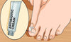 ingrown toenail treatment